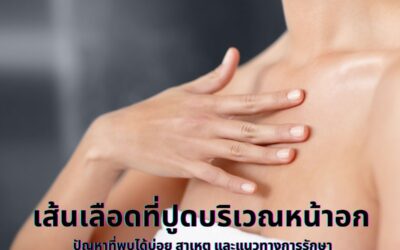 เส้นเลือดที่ปูดบริเวณหน้าอก: ปัญหาที่พบได้บ่อย สาเหตุ และแนวทางการรักษา