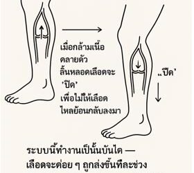 ลิ้นหลอดเลือดรั่ว คืออะไร? ทำไมจึงทำให้เกิดเส้นเลือดขอด