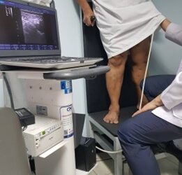 Varicose Veins: When Compression Stockings Don’t Reduce Swelling, It May Be Time to Find the Real Cause