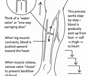What Is a Leaky Venous Valve? Why It Causes Varicose Veins