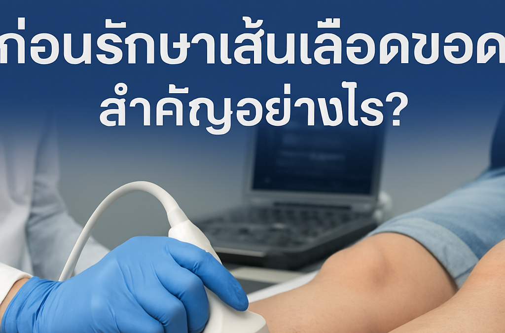 อัลตร้าซาวด์หลอดเลือดดำก่อนรักษาเส้นเลือดขอด สำคัญอย่างไร?