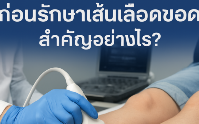 อัลตร้าซาวด์หลอดเลือดดำก่อนรักษาเส้นเลือดขอด สำคัญอย่างไร?